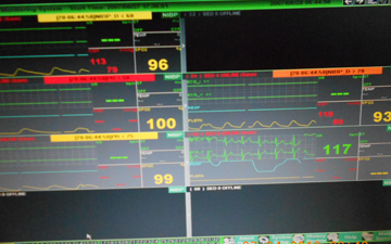 ICU